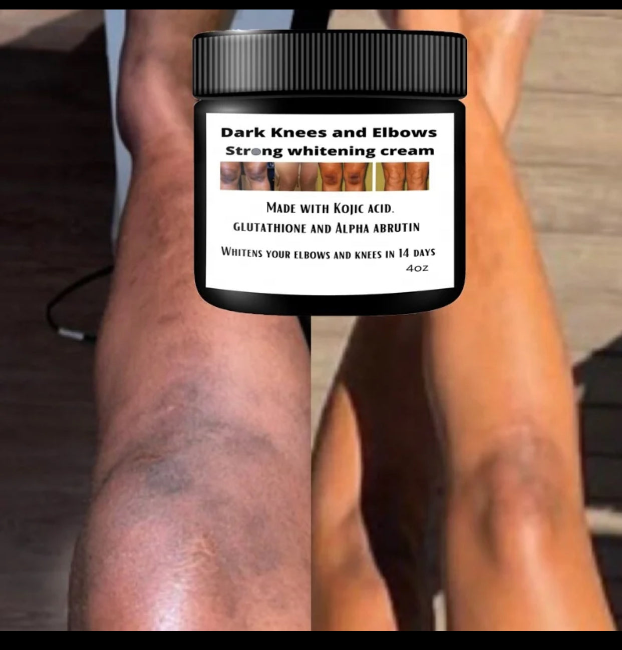 Dark knuckles cream, Potent Cream , Dark Spots remover, Real results - Kismet Beauty Brands