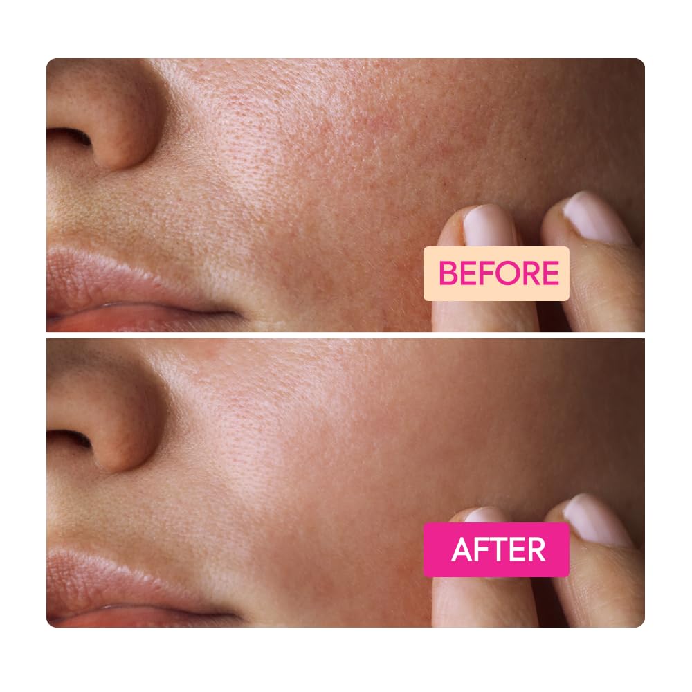 IYKYK By Makari Niacinamide Facial Cleansing Bar – Minimizes Pores and Gently Exfoliates, Unscented Soap