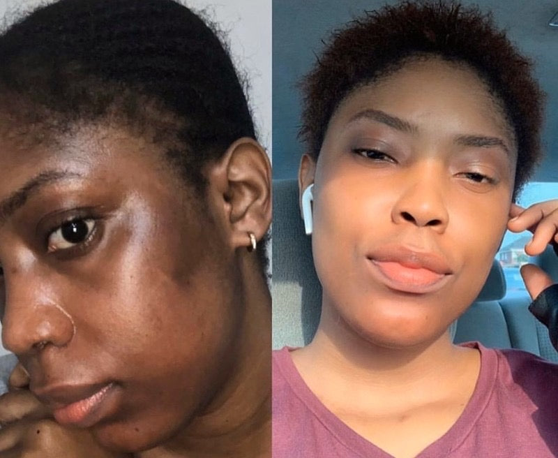 ADVANCE WHITE Dark knuckles cream, Potent Cream , Dark Spots remover, Real results