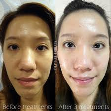 Asian white Snail Mucin seed oil and retinol lotion Asian white