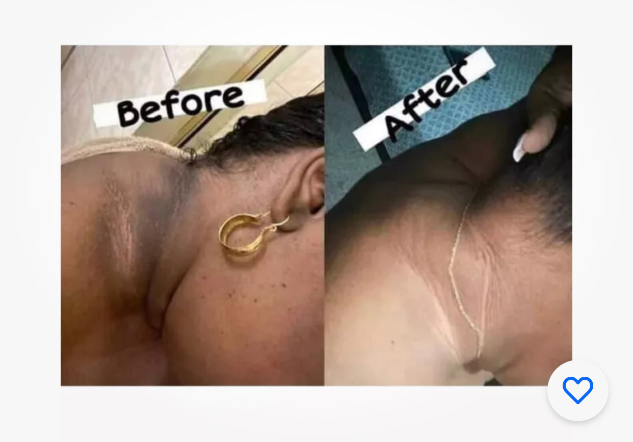 RWT knuckles Remover dark knuckles elbow feet remover 5 Days actions