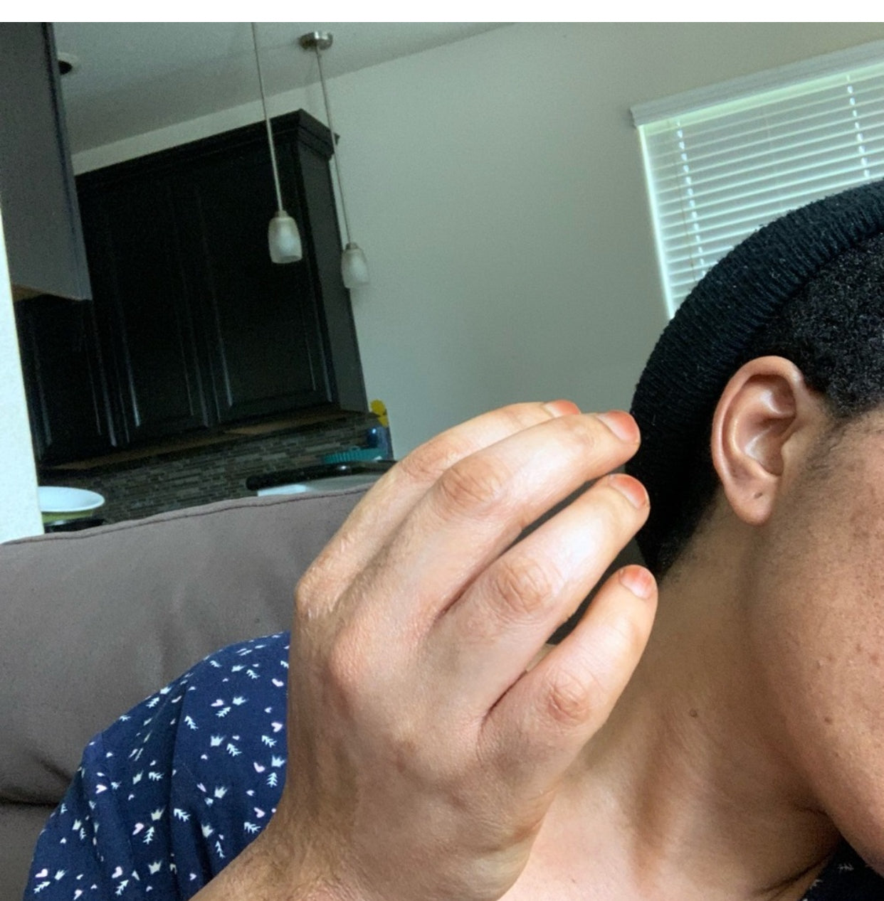 Caro White Tube Cream 1 oz / 30 g - Kismet Beauty Brands