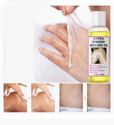Extra Strong Peeling Oil for Deep Exfoliation, Dark Spot Clearing & Stretch Mark Repair – 110ml