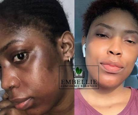 KOJIC Papaya Papaya Carrot Vit C&E KOJIC ACID PLUS Whitening Formula Soap 4.5 oz / 135 gr