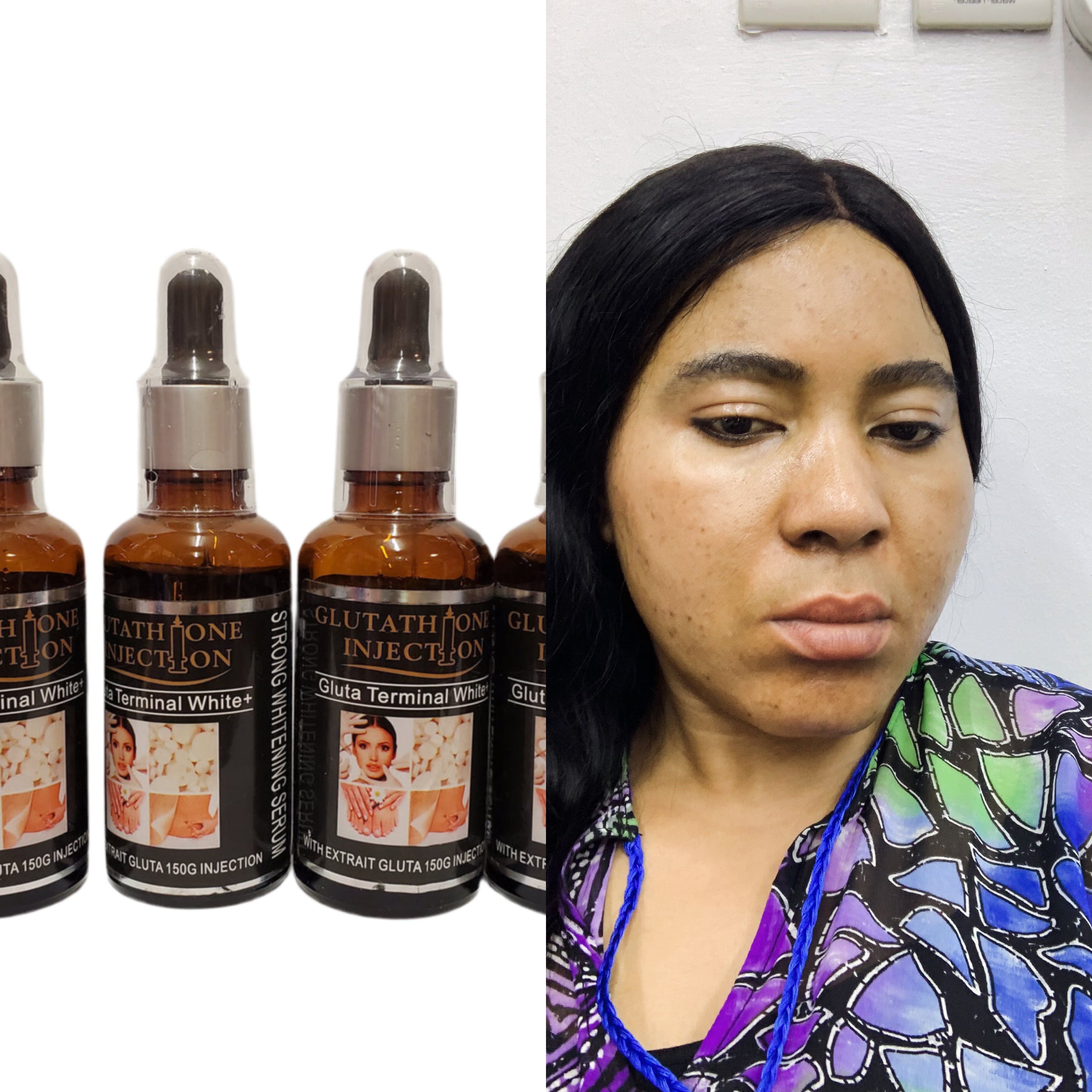 GLUTATHIONE INJECTION GLUTA TERMINAL WHITE + EXTRAIT GLUTA 150G INJECTION