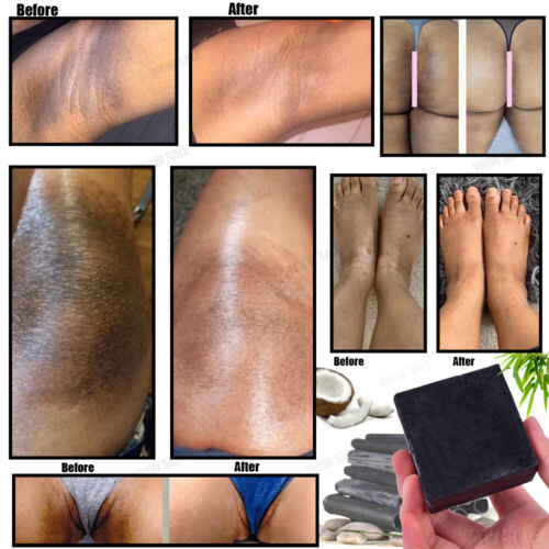 FINAL WHITE (CEMAC / Lemon / Yellow Color) Feet & Hands CONCENTRE 2 oz / 60ml African Black Bar Soap