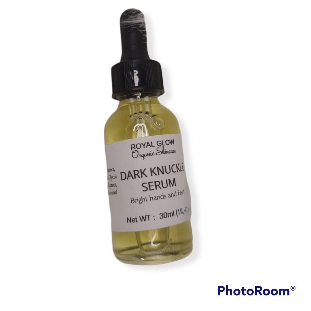 Dark knuckles cream, Potent Cream , Dark Spots remover, Real results RoyalGlow Organics