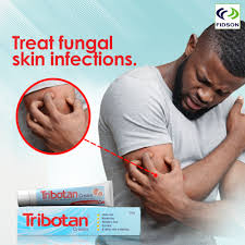 TRIBOTAN CREAM – 20g (FIDSON)