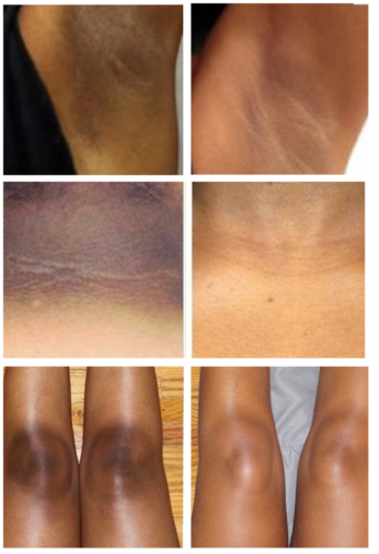 White Secret Dark Sot Remover Soap 90gr white secret