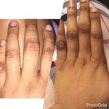 Precious Skin Brightening Tube Cream 1.7 6 oz / 50 g PRECIOUS