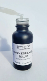 Dark knuckles cream, Potent Cream , Dark Spots remover, Real results RoyalGlow Organics