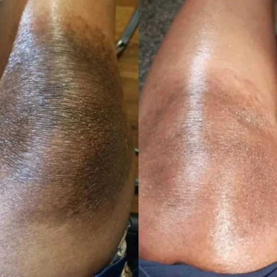 Glutathione Strong Whitening Cream Terminal White Tube Cream, Potent Cream , Dark Spots remover, Real results x1 Glutathione Drip