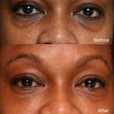 Clear Essence Platinum Skin Lightening under eye Serum 0.5oz / 15ml Clear Essance