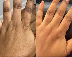 CARO CARE HUILE ECLAIRCISSANTE LIGHTENING OIL, Dark Spots remover, Real results CARO CARE