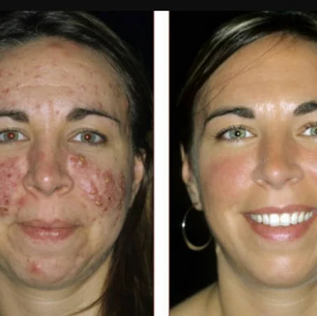 Miss U Nano Kojic Papaya