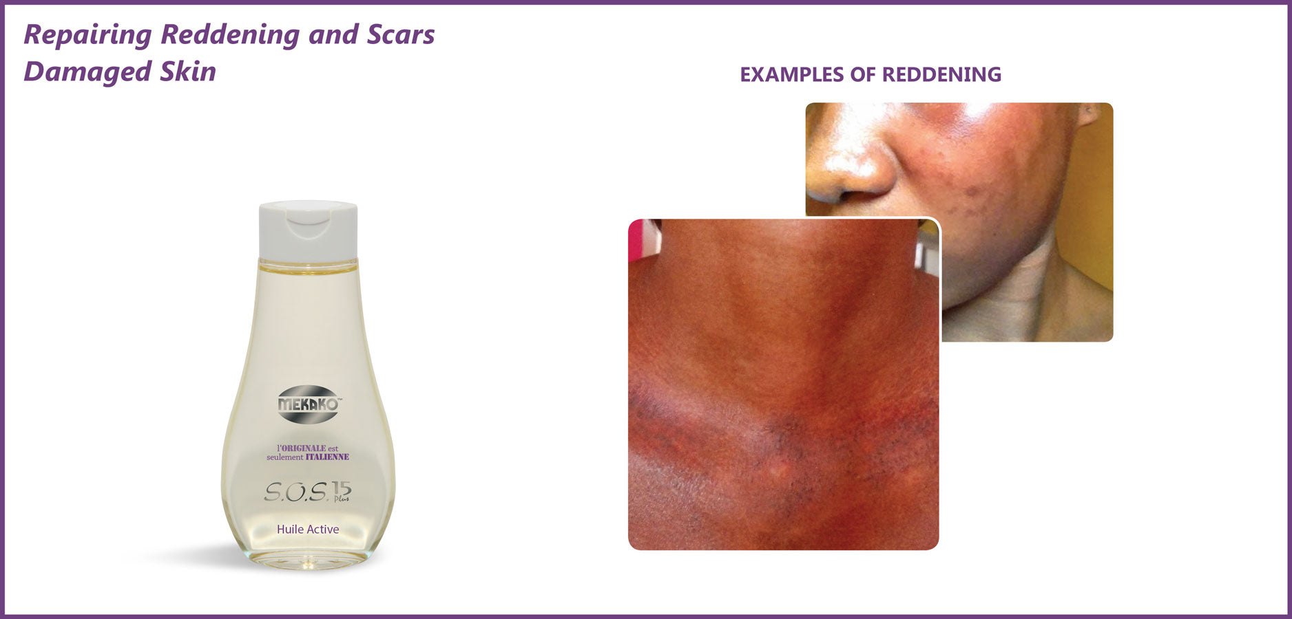 Mekako S.O.S. 15 Plus Active Oil 5.07 oz / 150 ml mekako