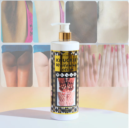 O’Carly Knuckle Lotion – Brightening &amp; Moisturizing Formula (500 ml)