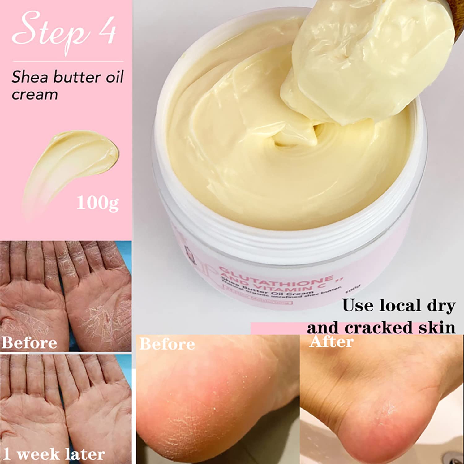 AILKE Organic Unrefined Shea Butter Face & Body Moisturizing Cream
