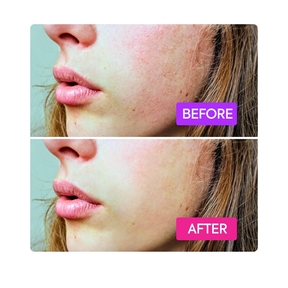 IYKYK By Makari Probiotics Booster for Skin Barrier Support – Soothing Face &amp; Neck Hydration Serum