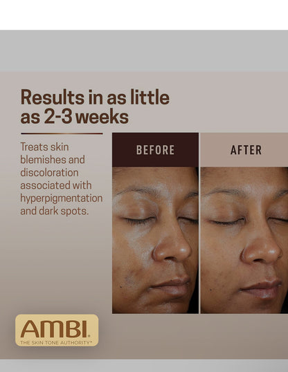 Ambi Even &amp; Clear Fade Cream X1 TUBE