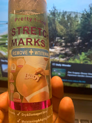 PRETTY WHITE STRETCH MARKS REMOVER AND WHITENING RESTORES SKIN