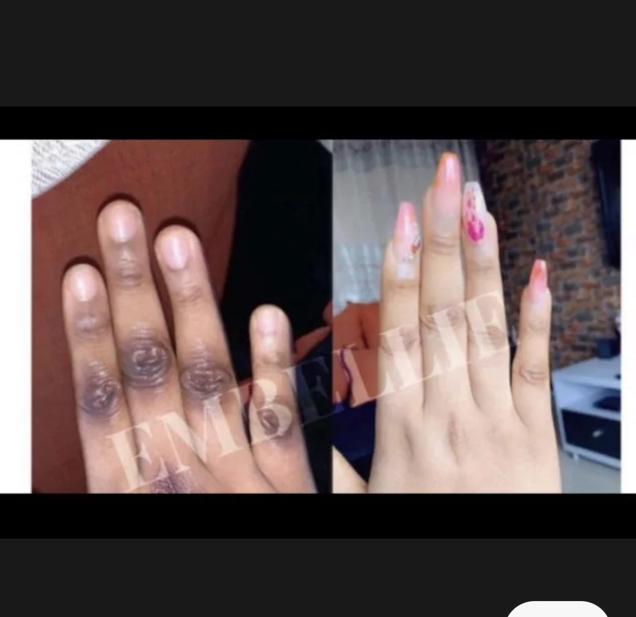 RWT knuckles Remover dark knuckles elbow feet remover 5 Days actions