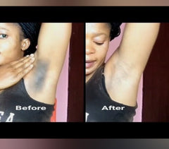 KISMET  Body Dark Spot Corrector oil. Fast Action with Vitamins C&E (Face, Knees, Neck, Elbows)