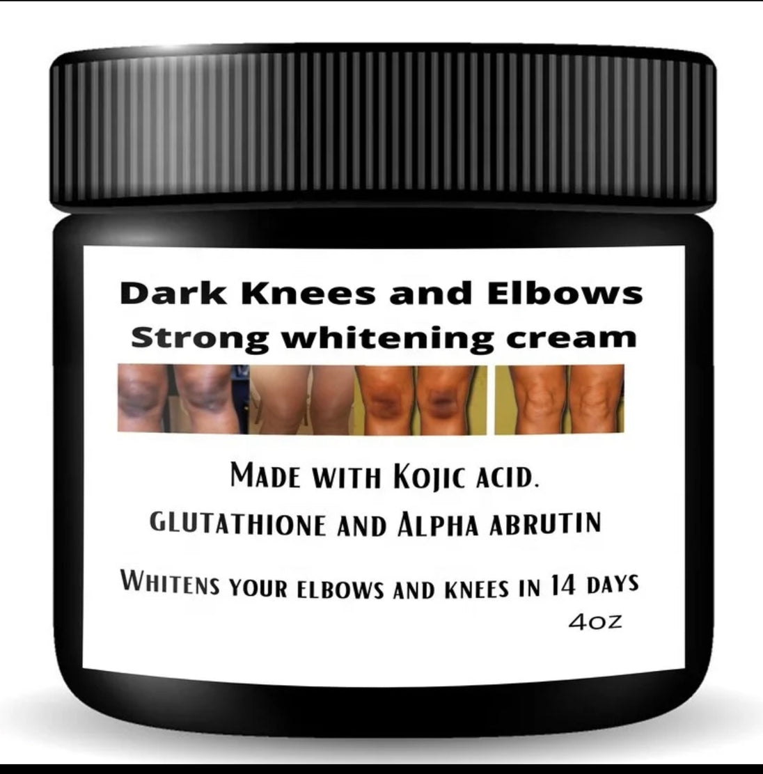 Dark knuckles cream, Potent  Cream , Dark Spots remover, Real results - Kismet Beauty Brands