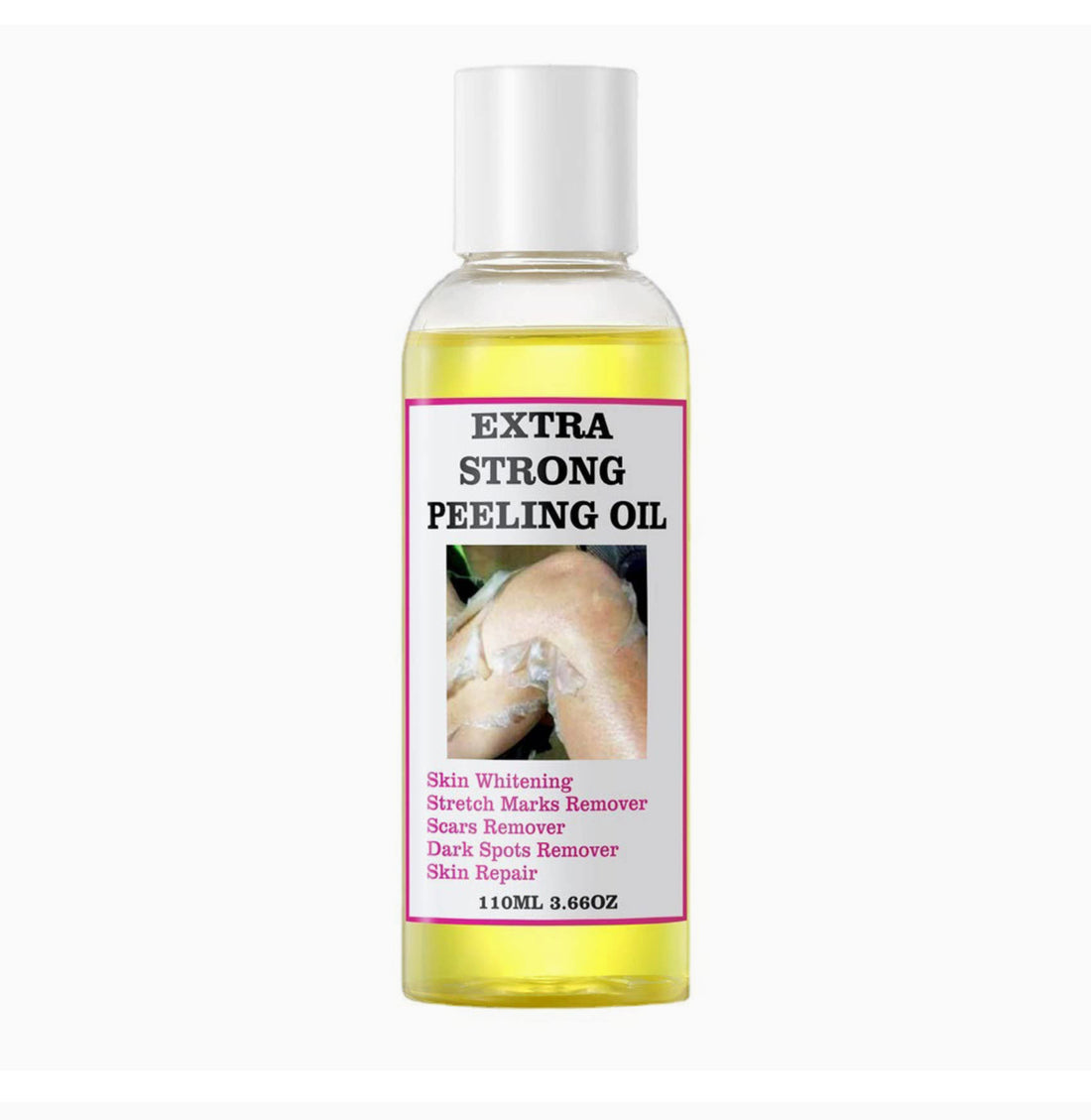 Yellow Peeling Oil Extra Strength for Dark Skin, Exfoliating Peeling Solution for Body All Skin Type Dead Skin Remover (1PC)