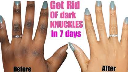 Kojic Clear Grace Action Cream x1