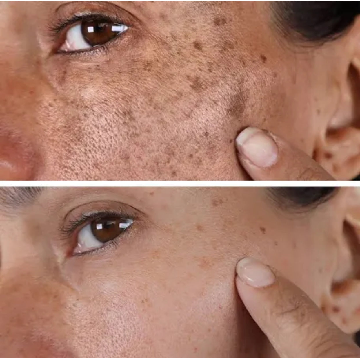 B B Clear Dark Spot Remover Freeshipping Kismet Beauty Brands b-b-clear-dark-spot-remover-freeshipping-kismet-beauty-brands