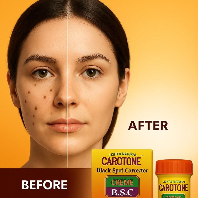 Carotone Black Spot Corrector 30ml x2 jars