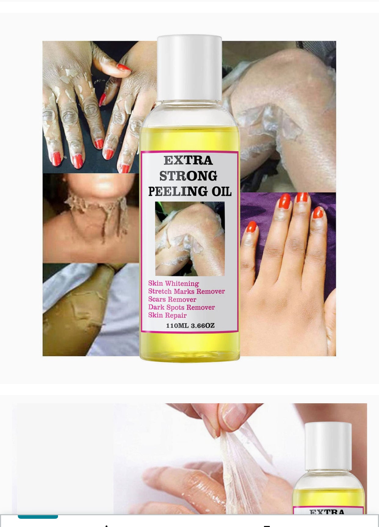 Yellow Peeling Oil Extra Strength for Dark Skin, Exfoliating Peeling Solution for Body All Skin Type Dead Skin Remover (1PC)