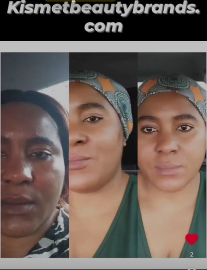 Extra Strong Snow White Whitening 10 days Fast Action with arbutin - Kismet Beauty Brands