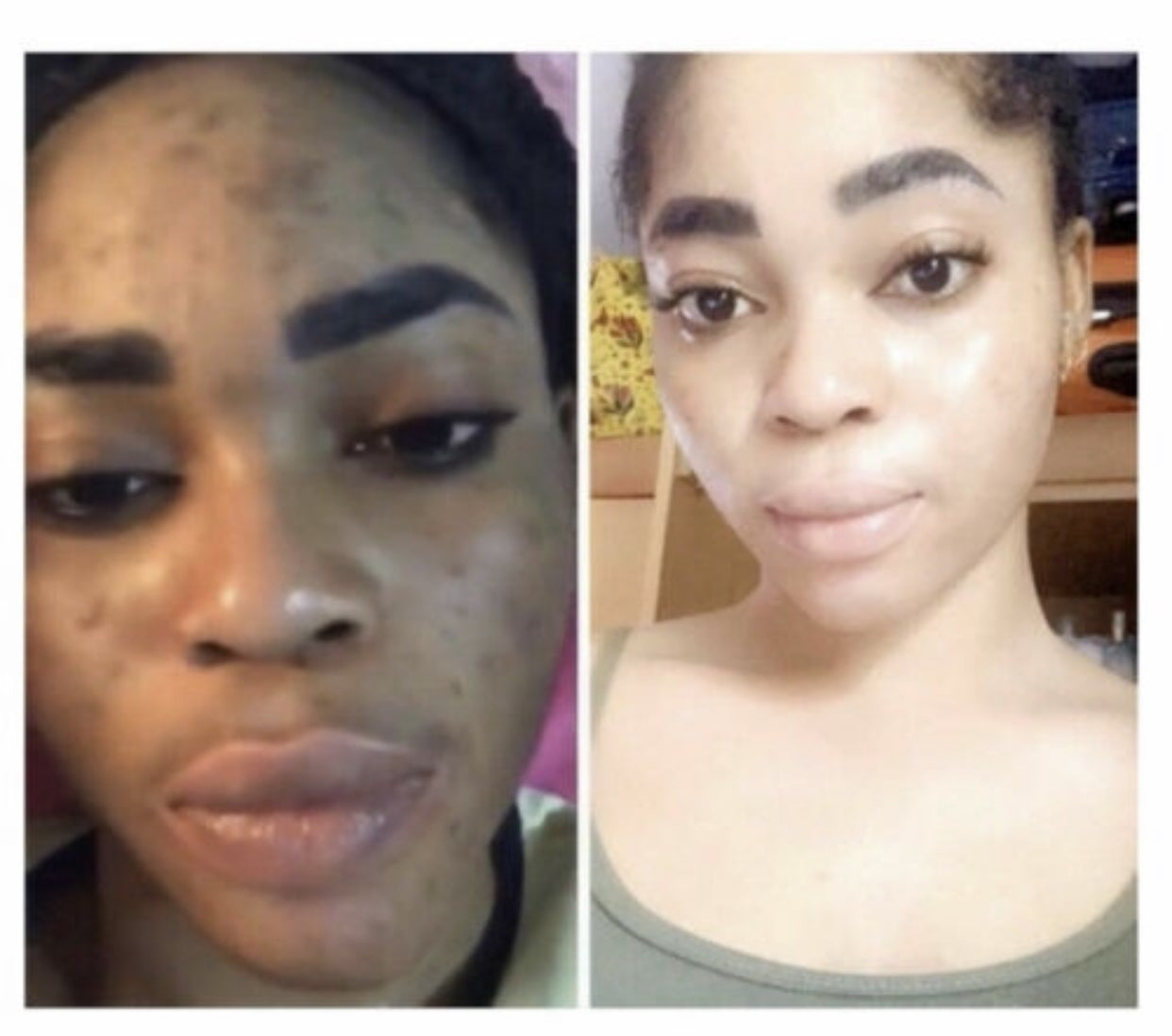 White Now Dark Spot Corrector cream. Fast Action with Vitamins C&amp;E (Face, Knees, Neck, Elbows) 3 pack white now