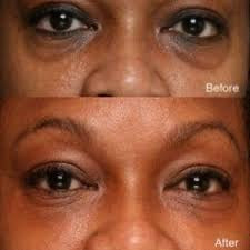 Clear Essence® Platinum Dark Circle Eye Serum (0.5 oz)