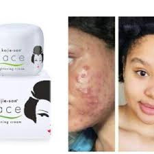 Kojie San Face Lightening Cream - Kismet Beauty Brands