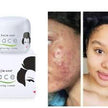 Kojie San Face Lightening Cream - Kismet Beauty Brands