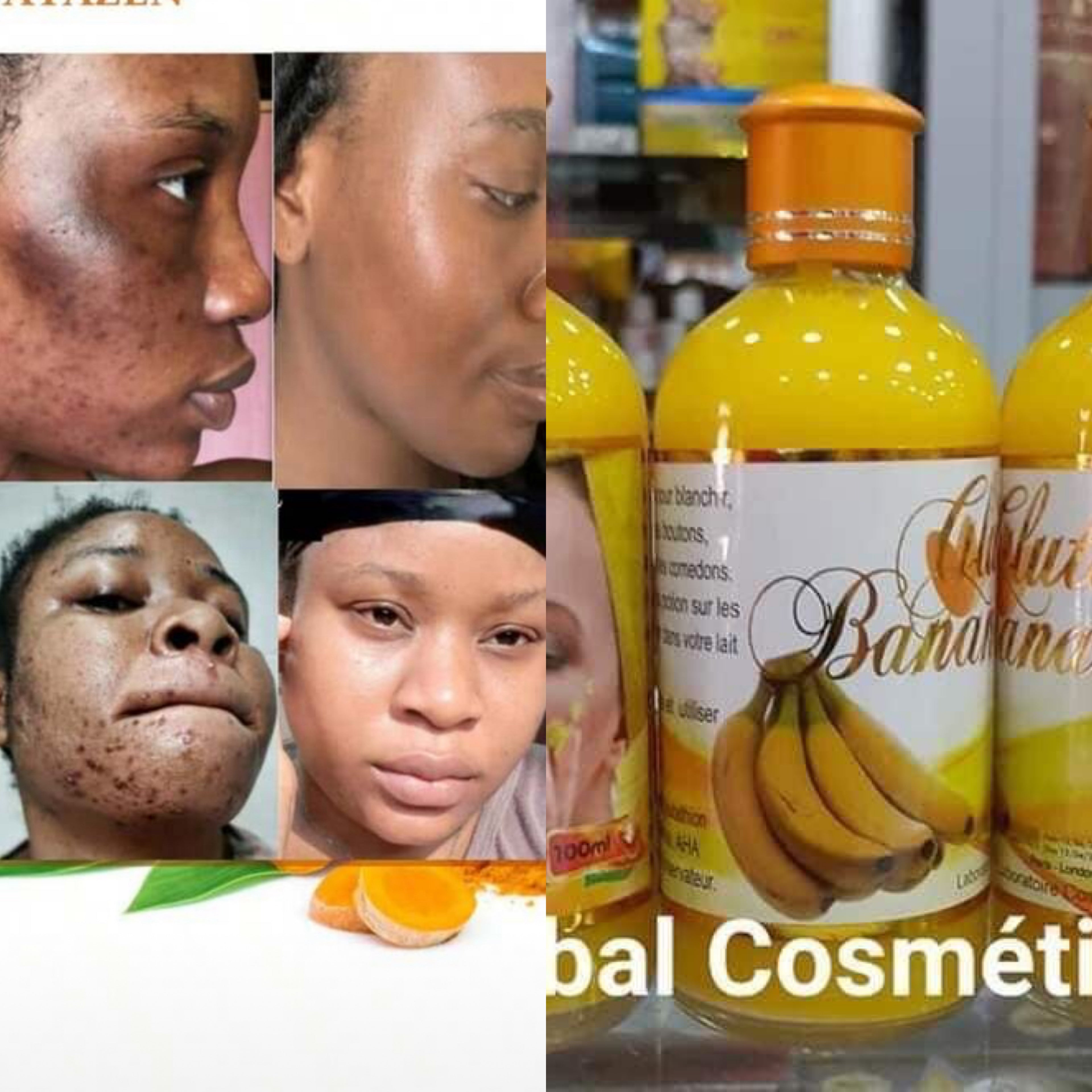 Gluta Banana Serum – Nourishing Tone Refining Skincare Serum