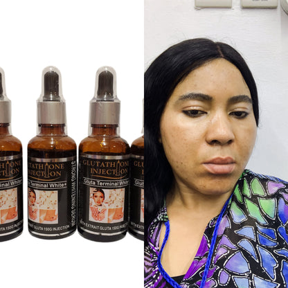 GLUTATHIONE INJECTION GLUTA TERMINAL WHITE + EXTRAIT GLUTA 150G INJECTION