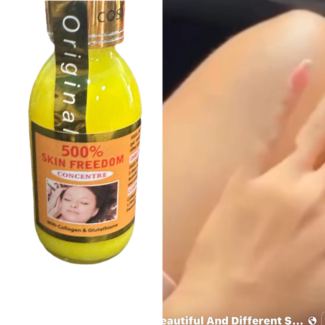 Skin Freedom 500 % Concentre 100 Ml
