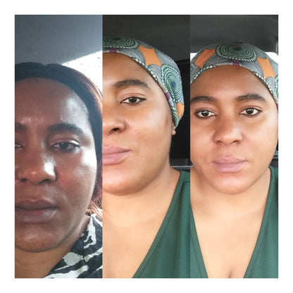 Lemon clear Dark Spot Corrector cream. Fast Action with Vitamins C&amp;E (Face, Knees, Neck, Elbows) (5 PACK) Lemon clear