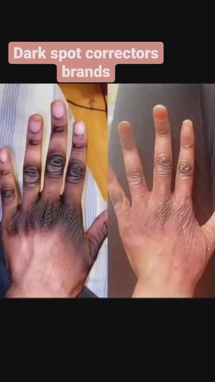 Perfect White 7 day Dark Spot Remover 40 ml