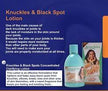 KNUCKLES & BLACK SPOTS CONCENTRATED CLARIFYING LOTION RoyalGlow Organics