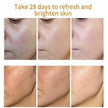 Glutathione Strong Whitening Potent  Cream, Dark Spots remover, Real results x1 Glutathione Drip