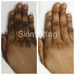 Bronz Tone Black Spot Corrector Jar Cream 1 oz Bronz Tone