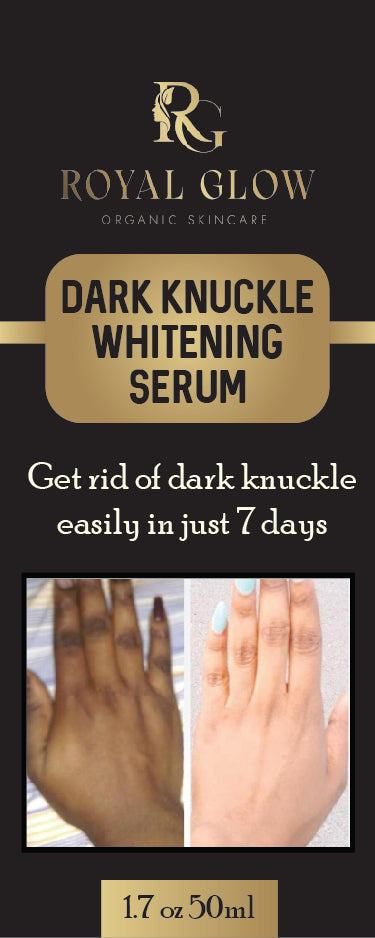 Dark knuckles cream, Potent  Cream , Dark Spots remover, Real results RoyalGlow Organics