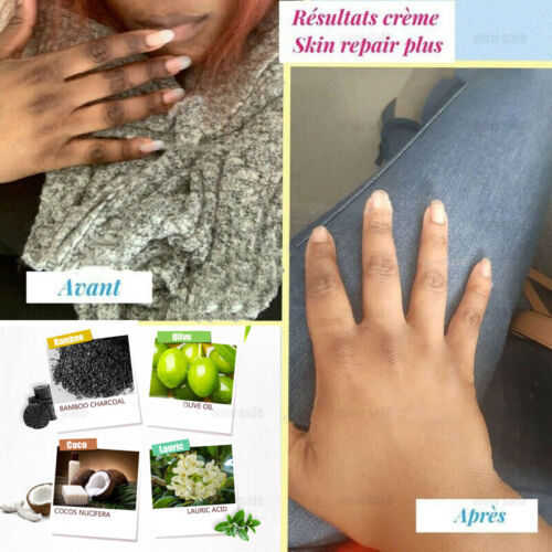 LUMINE FACE &amp; BODY LOTION EXTRAL STRONG WHITENING 3 IN 1 Dark Knuckle Remover RoyalGlow Organics