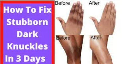 Kojic Clear Concentrated lightening Serum KOJIC CLEAR