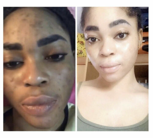 SKIN DOCTOR PARIS EGYPTIAN GLOW ULTRA RADIANCE PURE WHITENING BODY MILK +SERUM+SOAP Skin doctor